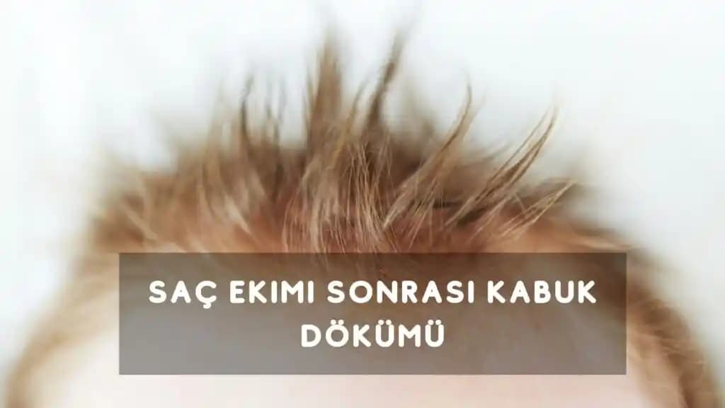 Keratin Sonrası Saçta Kabuklanma Nedenleri ve Etkili Çözüm Yolları