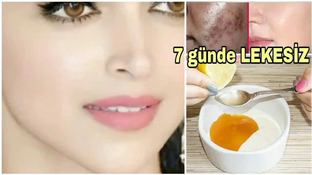 Kırmızı Sivilce Lekeleri İçin Etkili Bakım Yöntemleri ve Cilt Yenileme Tavsiyeleri