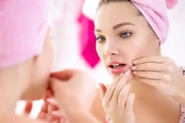 Kolda Sivilce İçin Doğal Bakım Yöntemleri ve Güvenli Çözümler