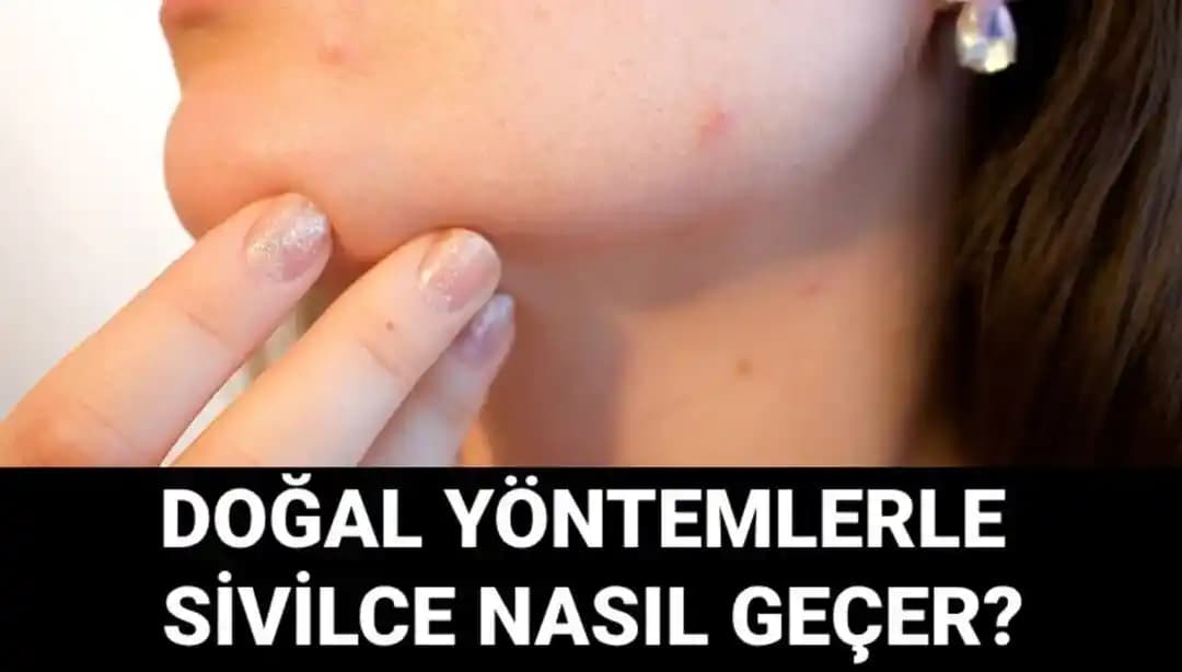 Koldaki Sivilceler İçin Doğal Yöntemler ve Tedavi Alternatifleri