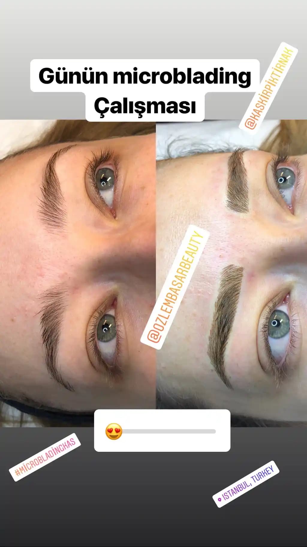 Londra'da Microblading ve Kalıcı Makyaj Hizmetleri: Uzman Uygulamalar ve Güvenilir Klinikler
