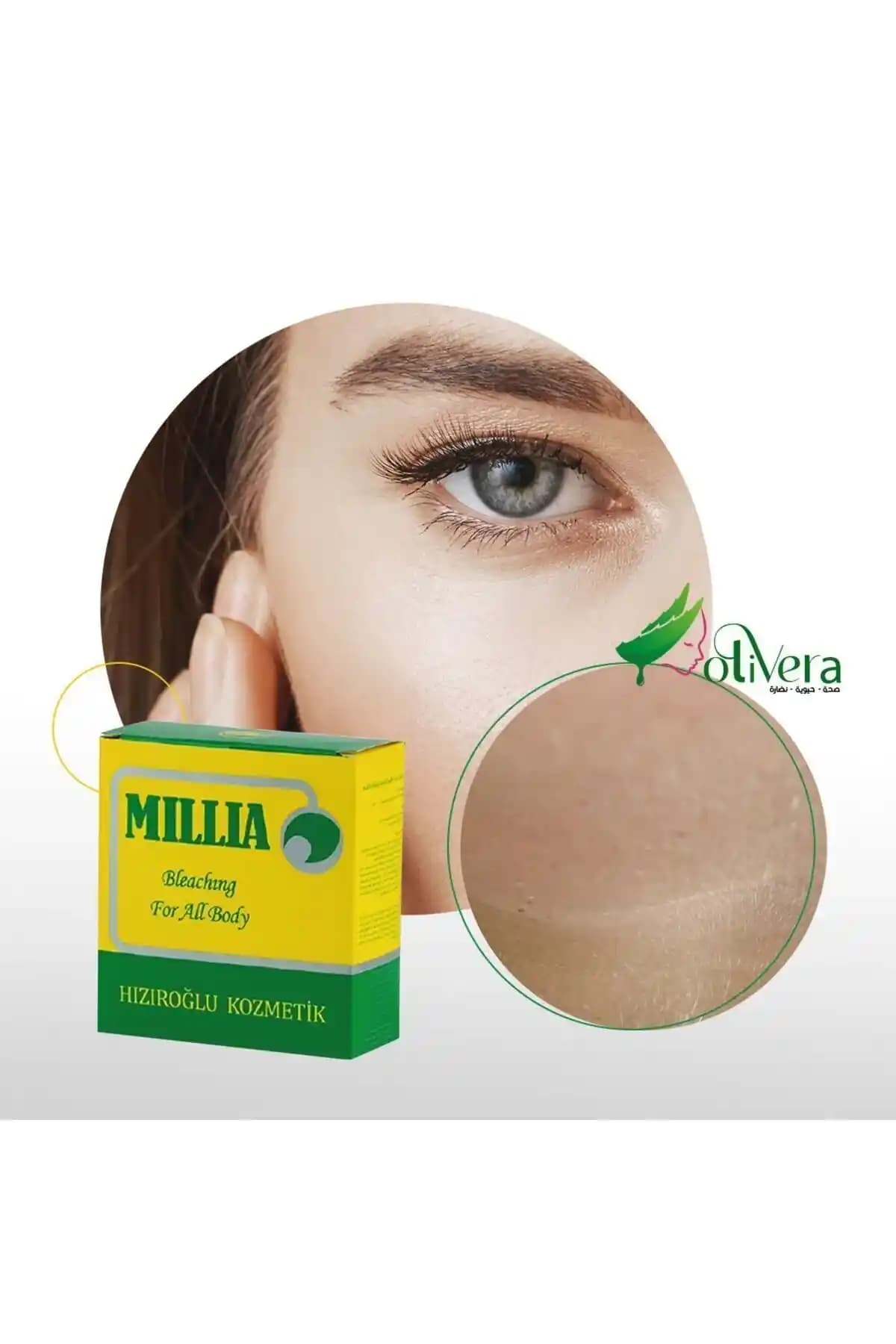 Milia Nedir, Neden Oluşur ve Etkili Bakım Yöntemleri Hakkında Bilgiler