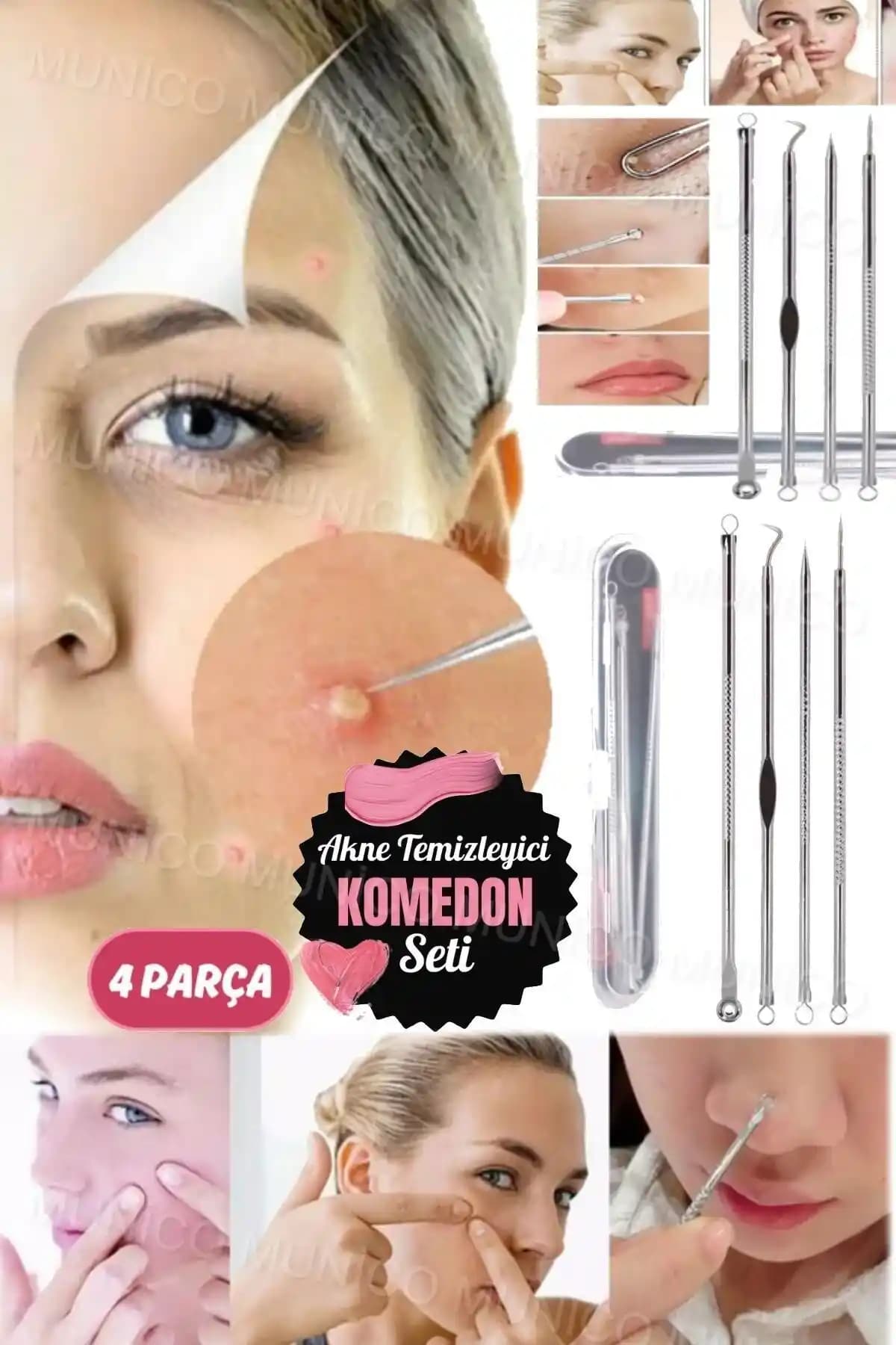 Paslanmaz Çelik Akne Temizleyici Setleri: Güvenli ve Uzun Ömürlü Cilt Bakım Çözümleri
