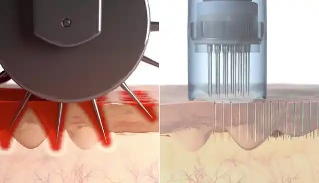 Renkli Dermaroller Kullanımı ve Özellikleri: Cilt Yenileme ve Güvenlik İpuçları