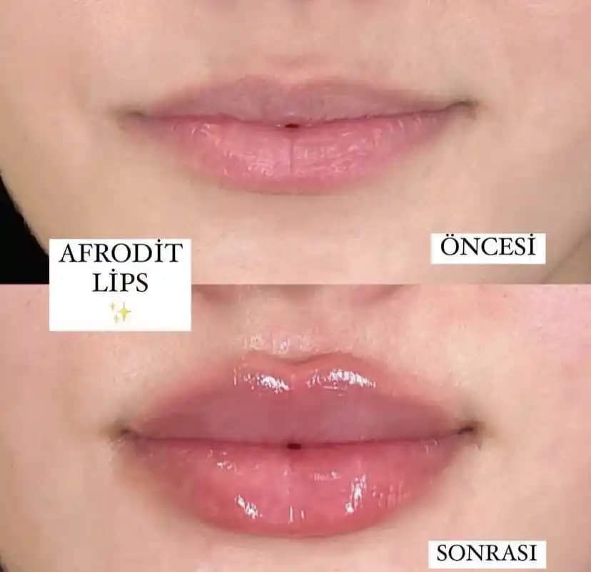 Rus Dudak Makyajı Trendleri: Güncel ve Çarpıcı Doğal Dudak Görünümü Teknikleri