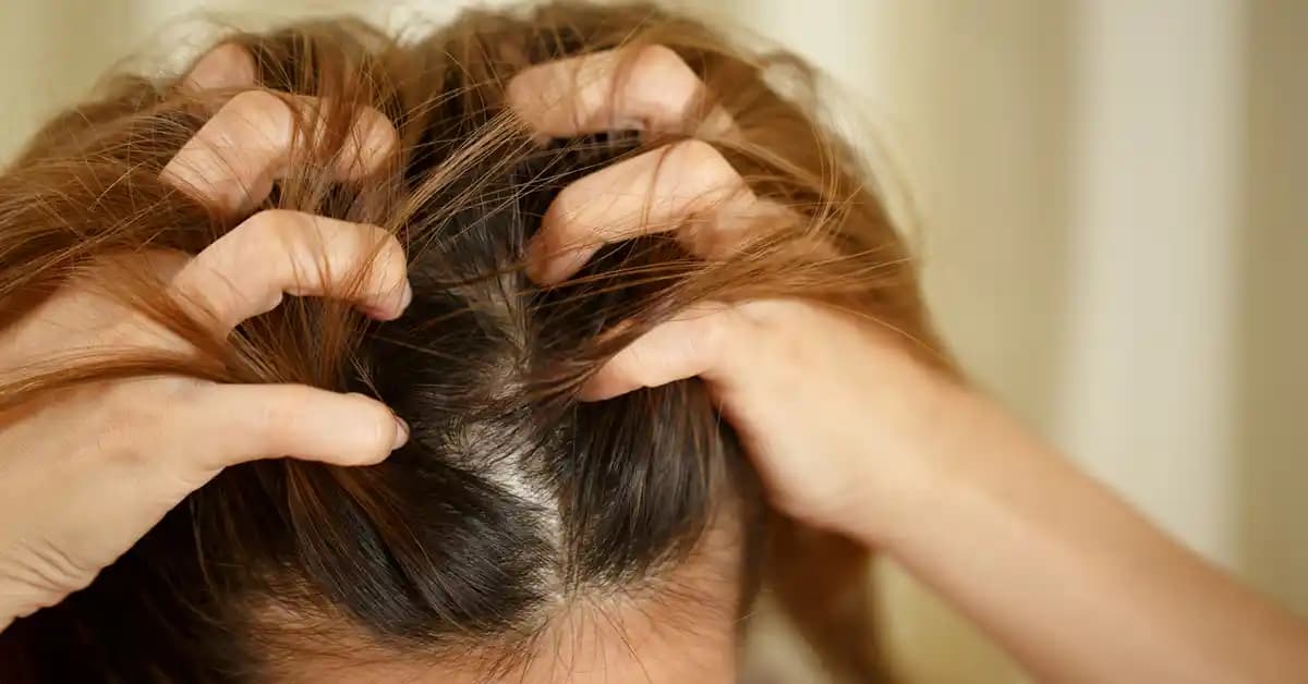 Saç Derisi Mantarları: Belirtileri, Nedenleri ve Doğru Bakım Yöntemleri