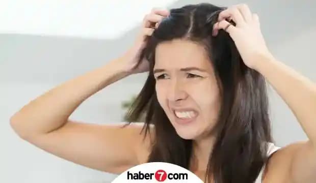 Saç Mantarı Tedavi Yöntemleri ve Doğru Bakım Uygulamaları