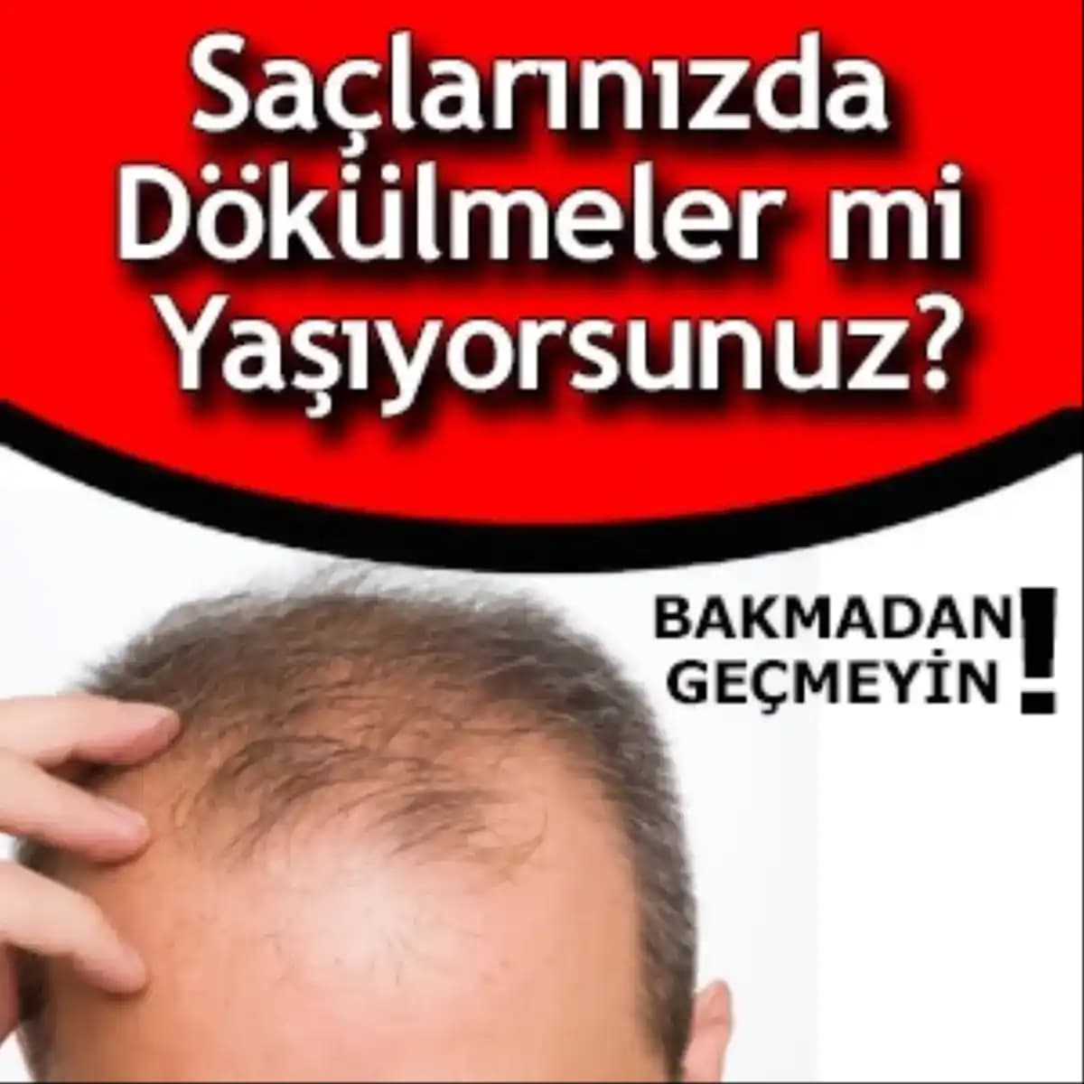 Saç ve Kepek Arasındaki Gerçekler Saç Dökülmesine Yaklaşım ve Koruma Yöntemleri