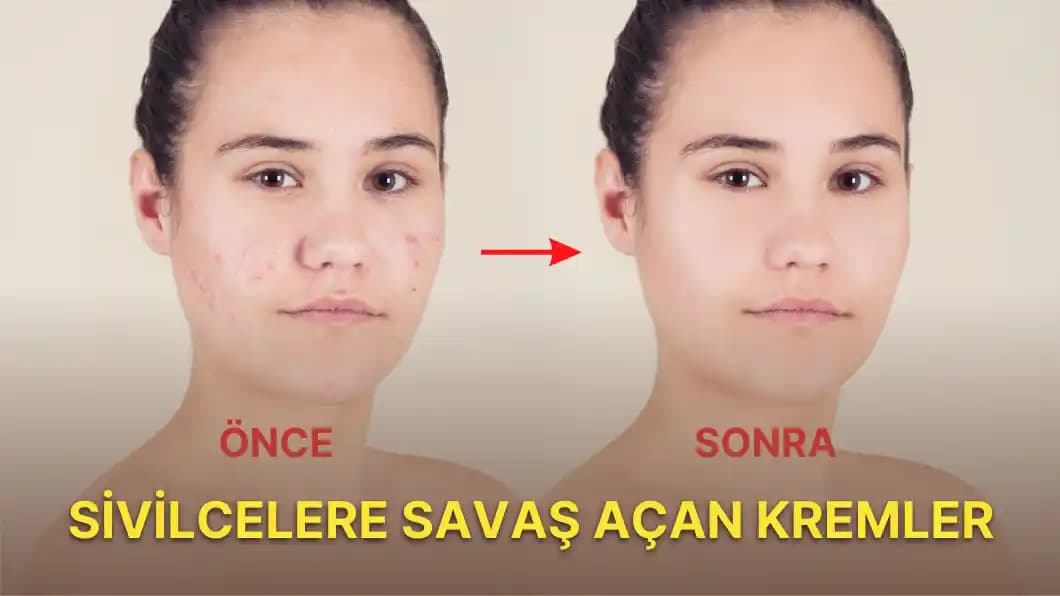 Sivilce Bakımında Temel İlkeler ve Doğru Ürün Seçimi Rehberi