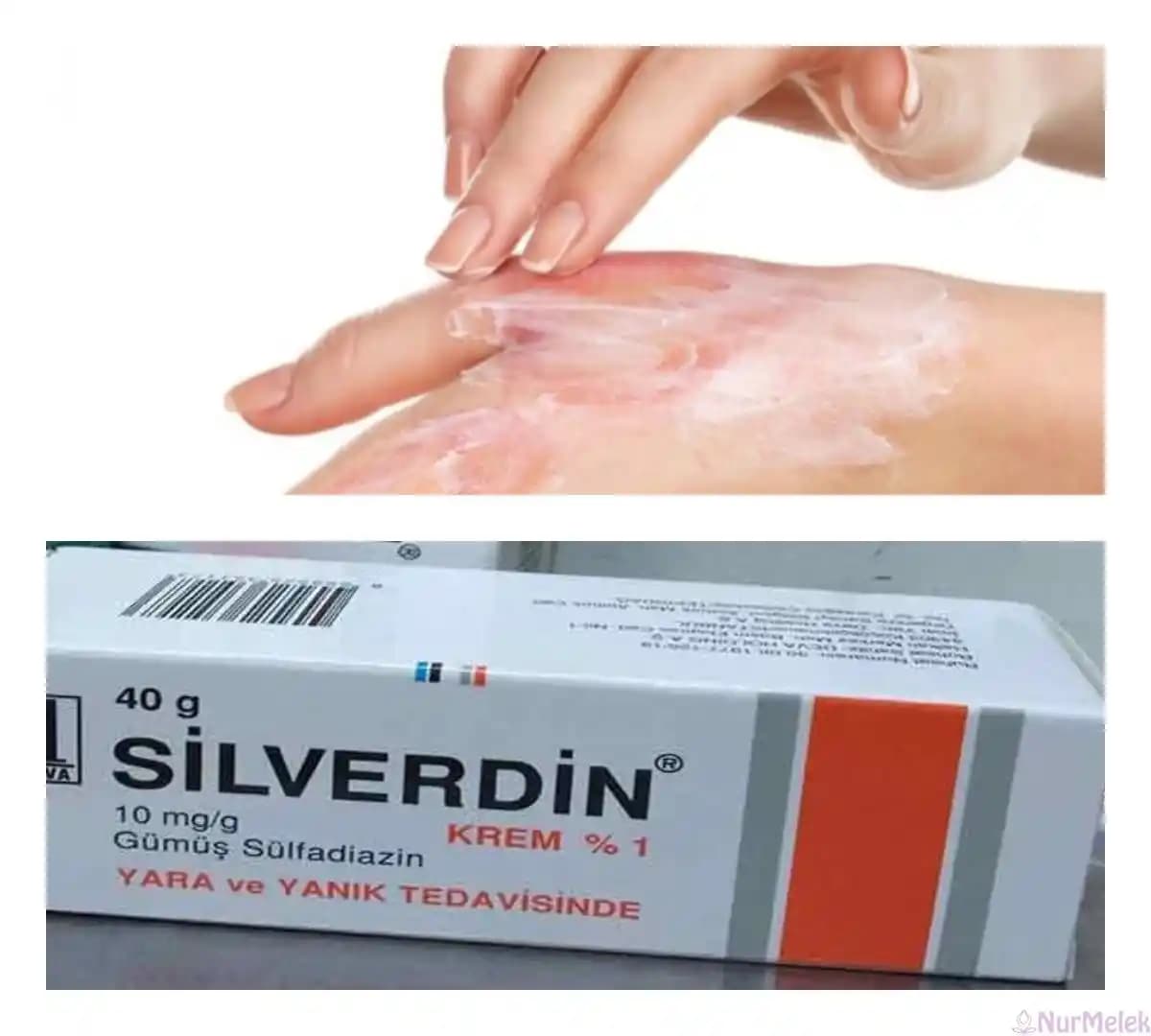 Yanık Yaraları İçin Güvenilir Bakım Kremleri ve Cilt Yenileme Yöntemleri