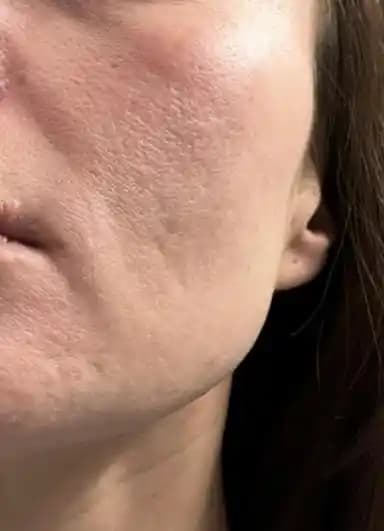 Cilt Dokusu ve Siyah Noktalar İçin Etkili Tedavi Yöntemleri ve Uzman Önerileri