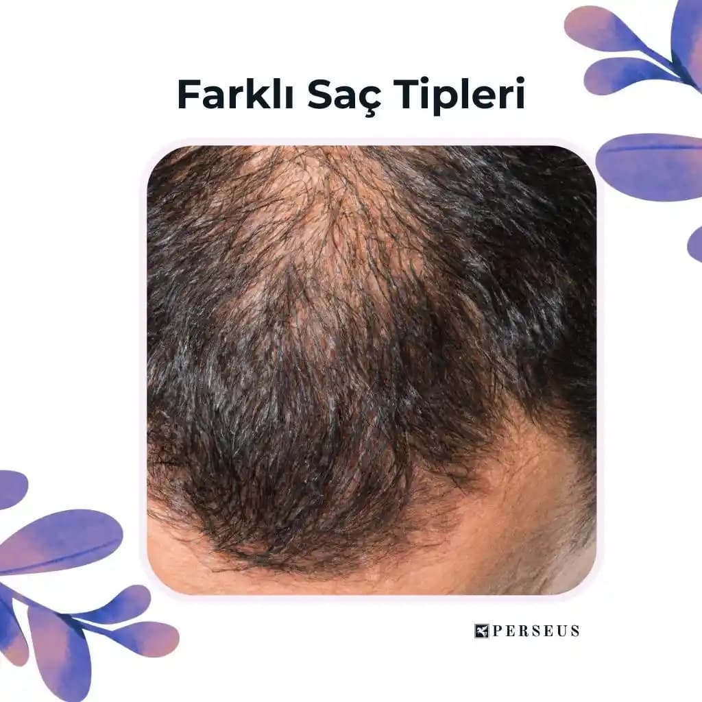 Doğu Asya Saç Tiplerinde Leave-In Kremlerin Sıcak ve Nemli İklimlerde Kullanımı ve Etkileri