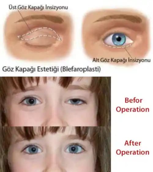 Kapüşonlu Gözler İçin Doğal ve Belirgin Makyaj Teknikleri ve İpuçları