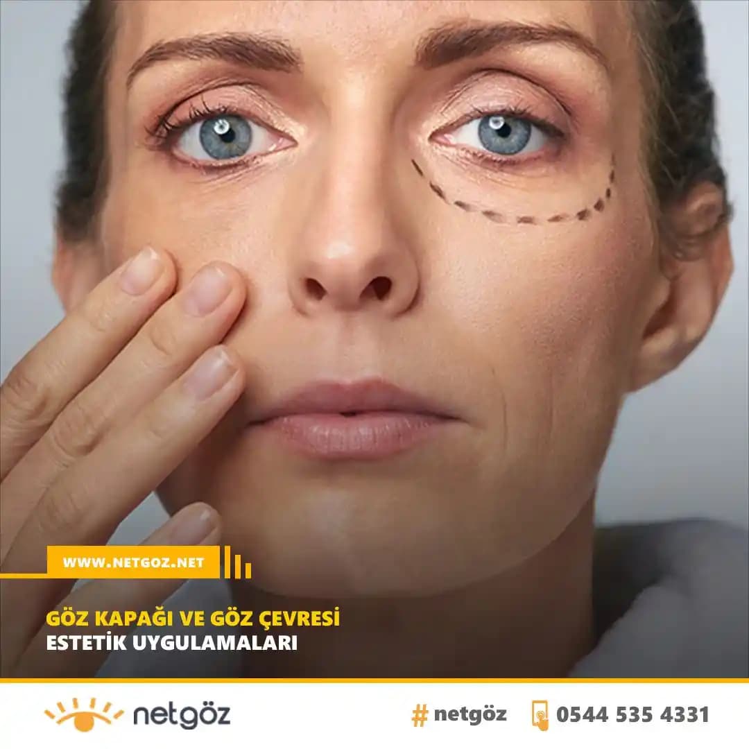 Kederin Yol Açtığı Göz Şişkinliği ve Yaşlanma Belirtilerinin Etkili Tedavi Yöntemleri