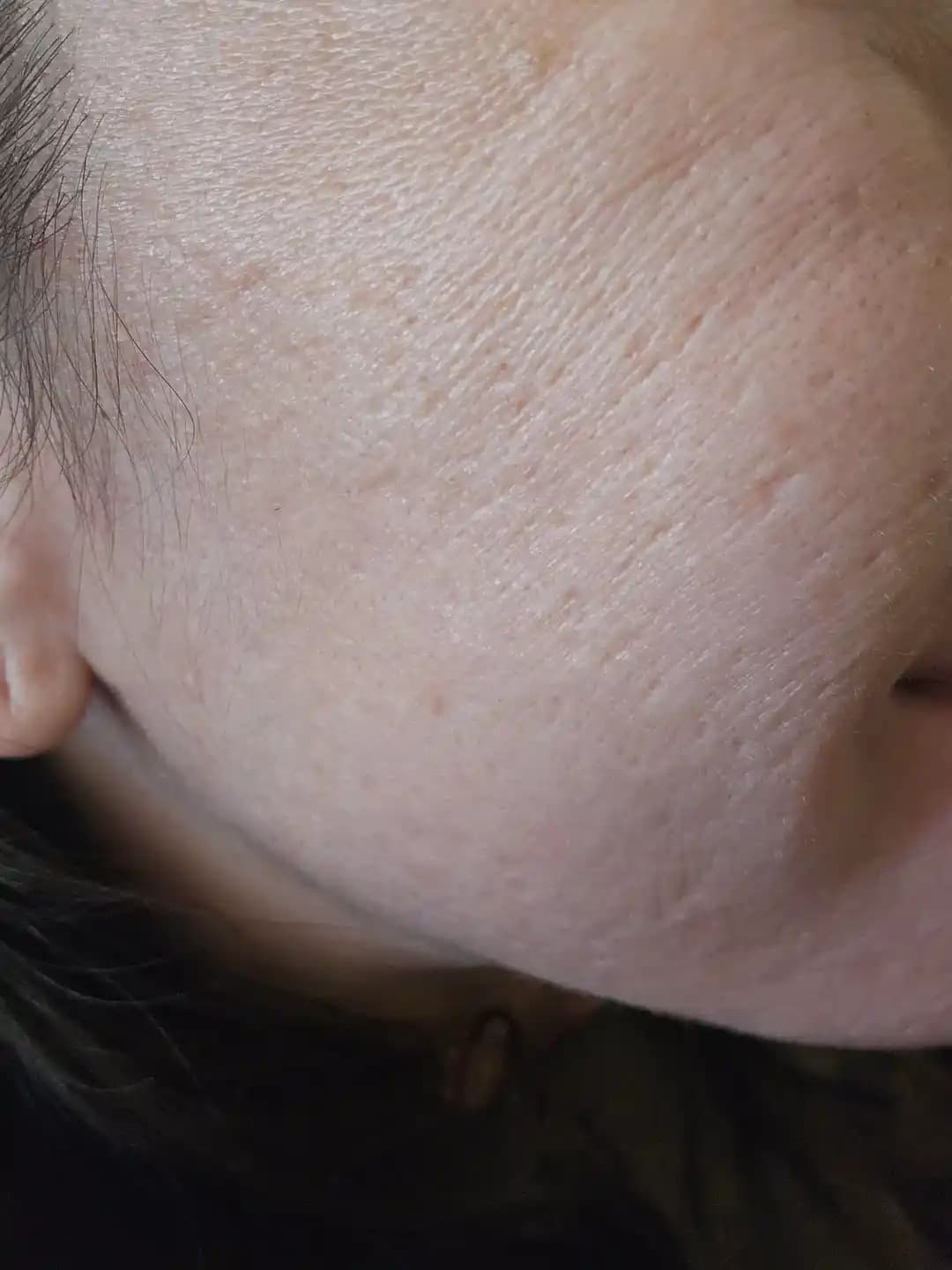 Kuru ve Dehidrasyon Belirtileri Gösteren Ciltler İçin Etkili Nemlendirme Stratejileri ve Bakım Önerileri