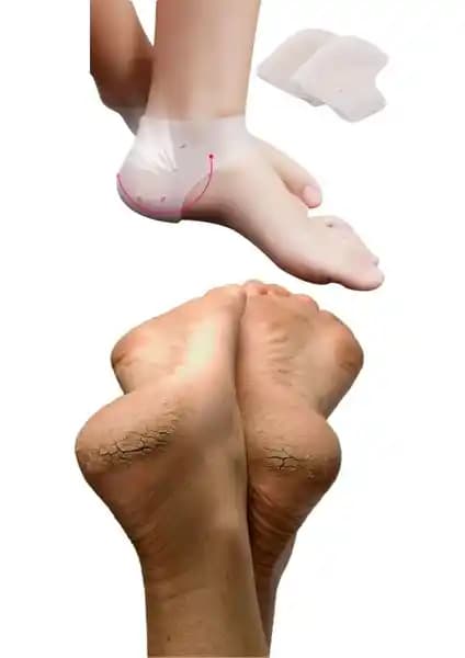 Perfect Delikli Silikon Topuk Çorabı: Ayak Sağlığı ve Şıklık İçin Modern Çözüm