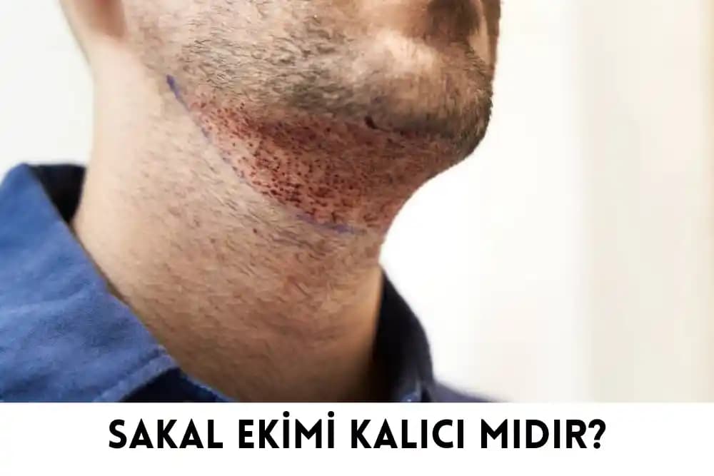 Sakal Yanığı ve Cilt Tahrişi: Nedenleri, Önlemleri ve Bakım Yöntemleri