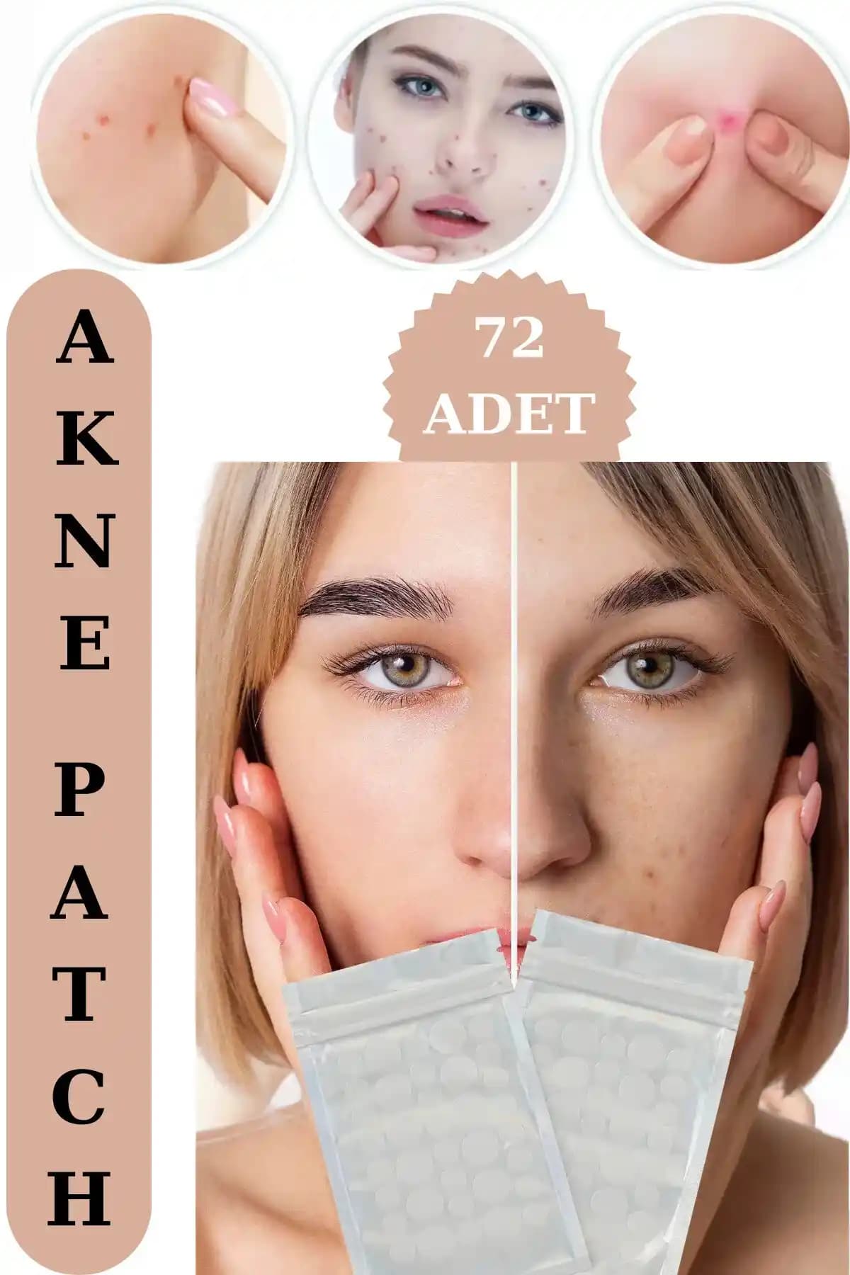 Ucuz ve Pahalı Sivilce Bantları Arasındaki Farklar ve Etkinlik Karşılaştırması