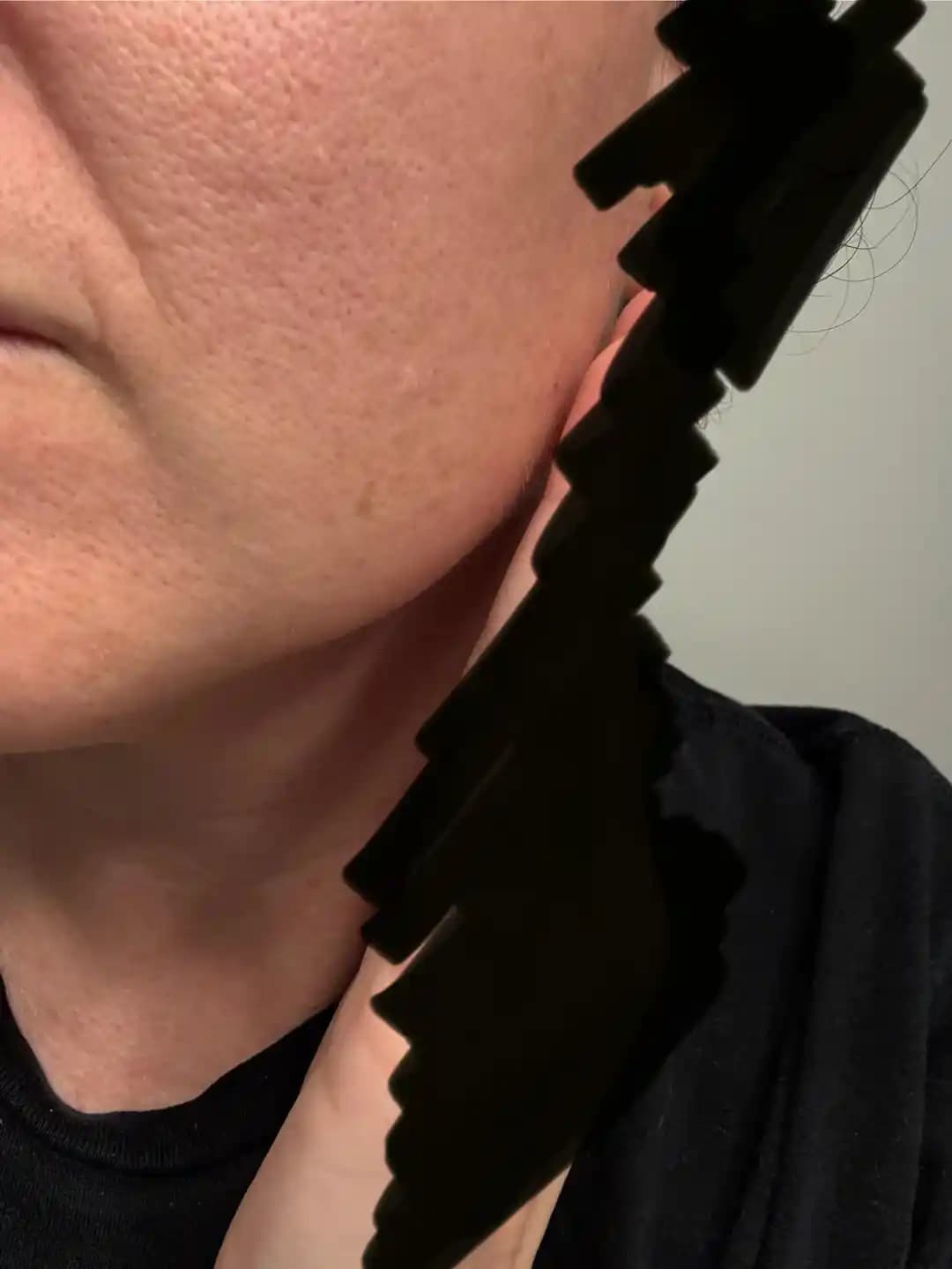 Uzun Gözeneklerin Nedenleri ve Cilt Bakımında Etkili Tedavi Yöntemleri