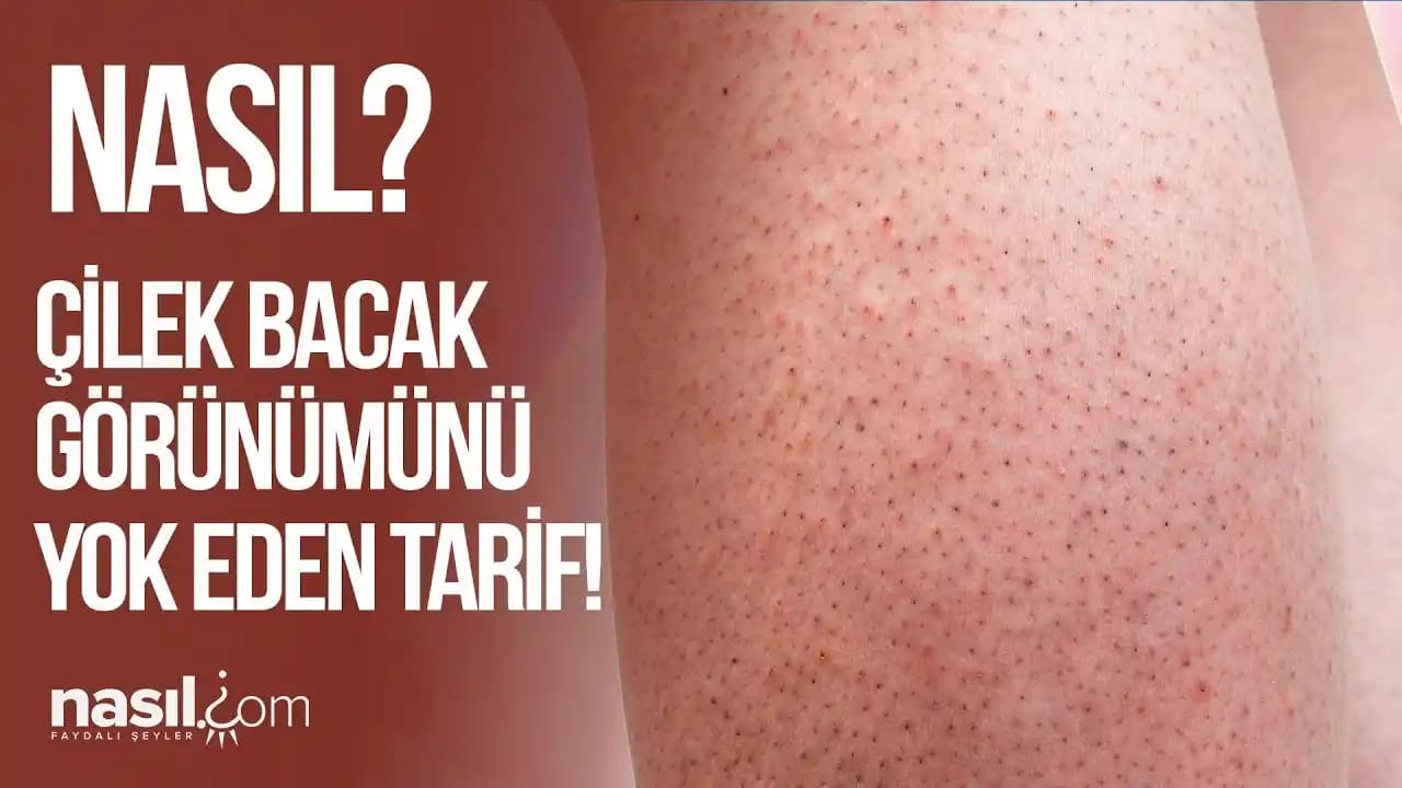 Çilek Bacaklar ve Tüy Alma Sonrası Sorunlar: Nedenler, Yöntemler ve Bakım Önerileri