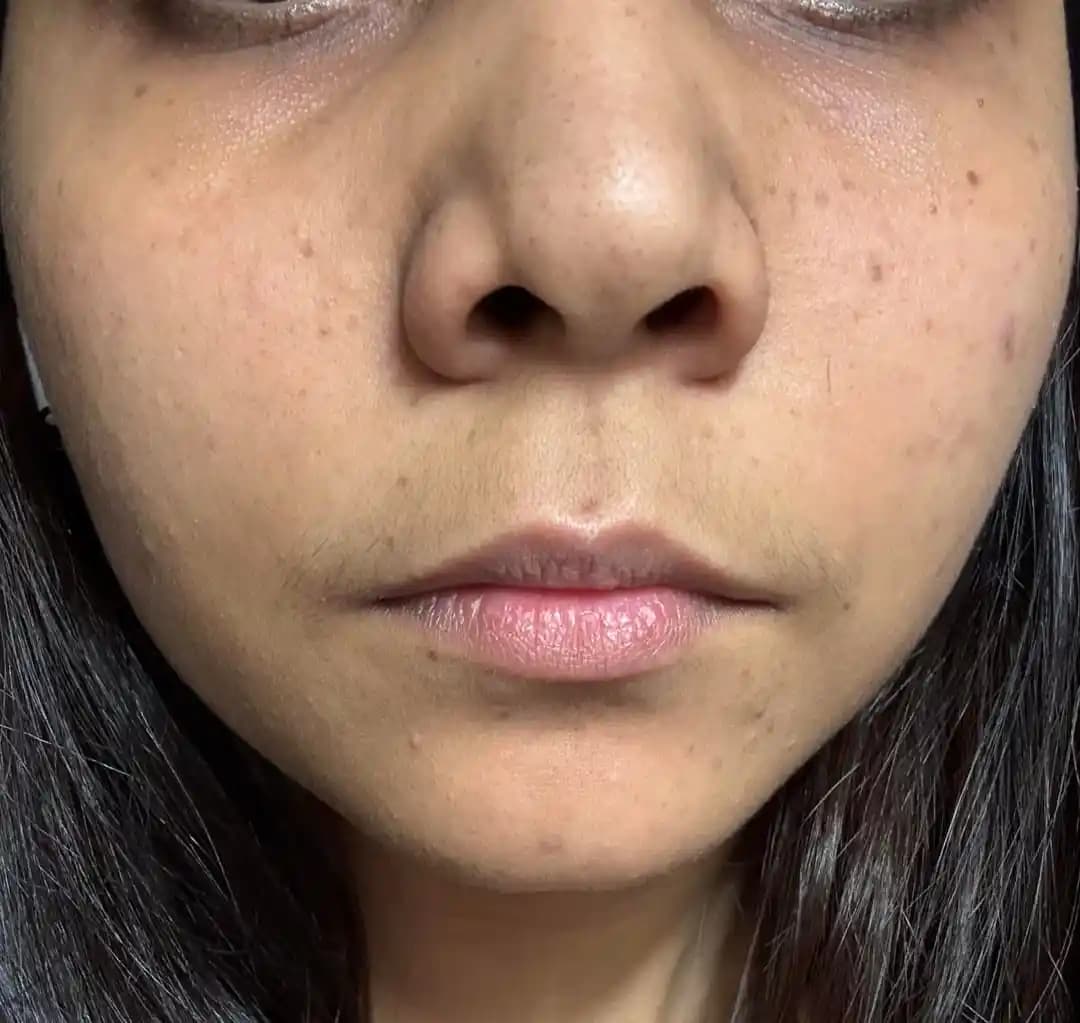 Cilt Temizliği ve Bakımı: Etkili Yöntemler, Aktif İçerikler ve Uzman Önerileri