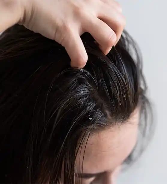 Hastane Sonrası Dolaşmış Saçların Nazikçe Çözülmesi İçin Etkili Yöntemler ve Ürünler