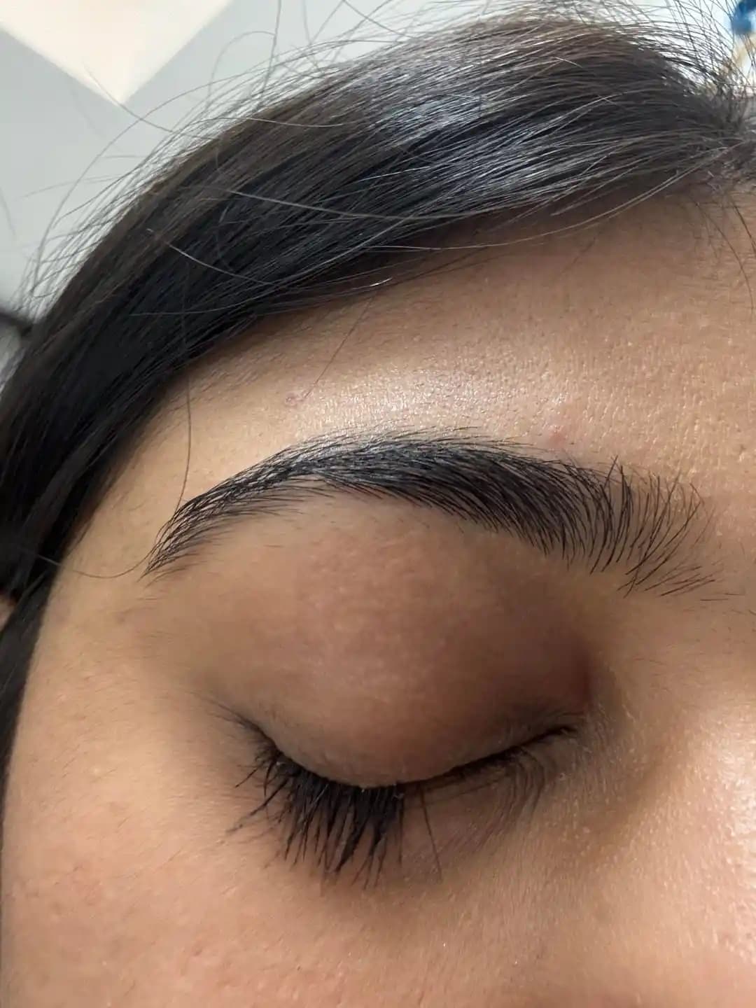 Kirpik Kopması: Nedenleri, Önlemleri ve Doğal İyileşme Yöntemleri