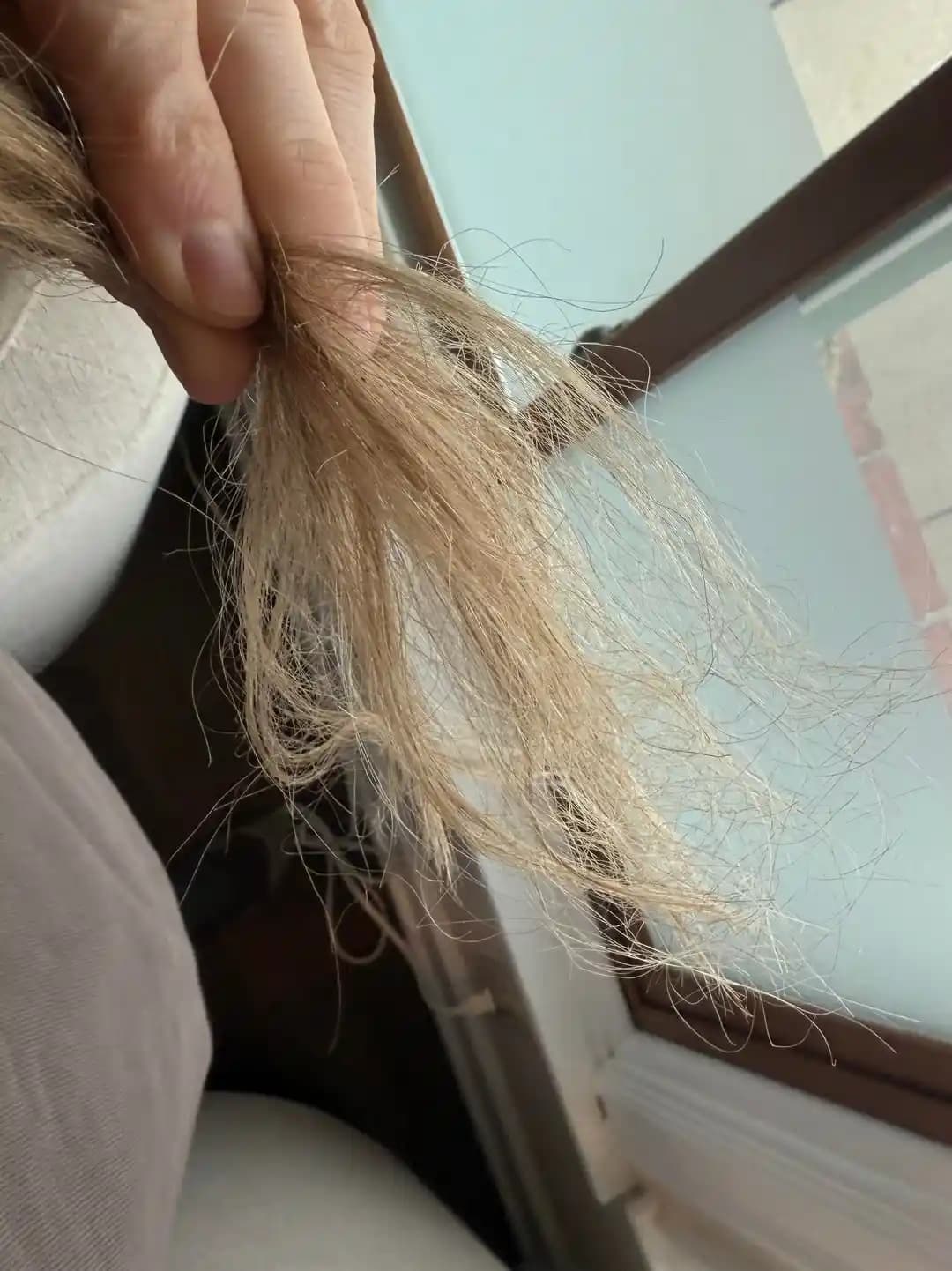 Stresin Saç Uçlarındaki Ani Değişimlere Etkisi ve Saç Sağlığını Korumaya Yönelik Çözümler