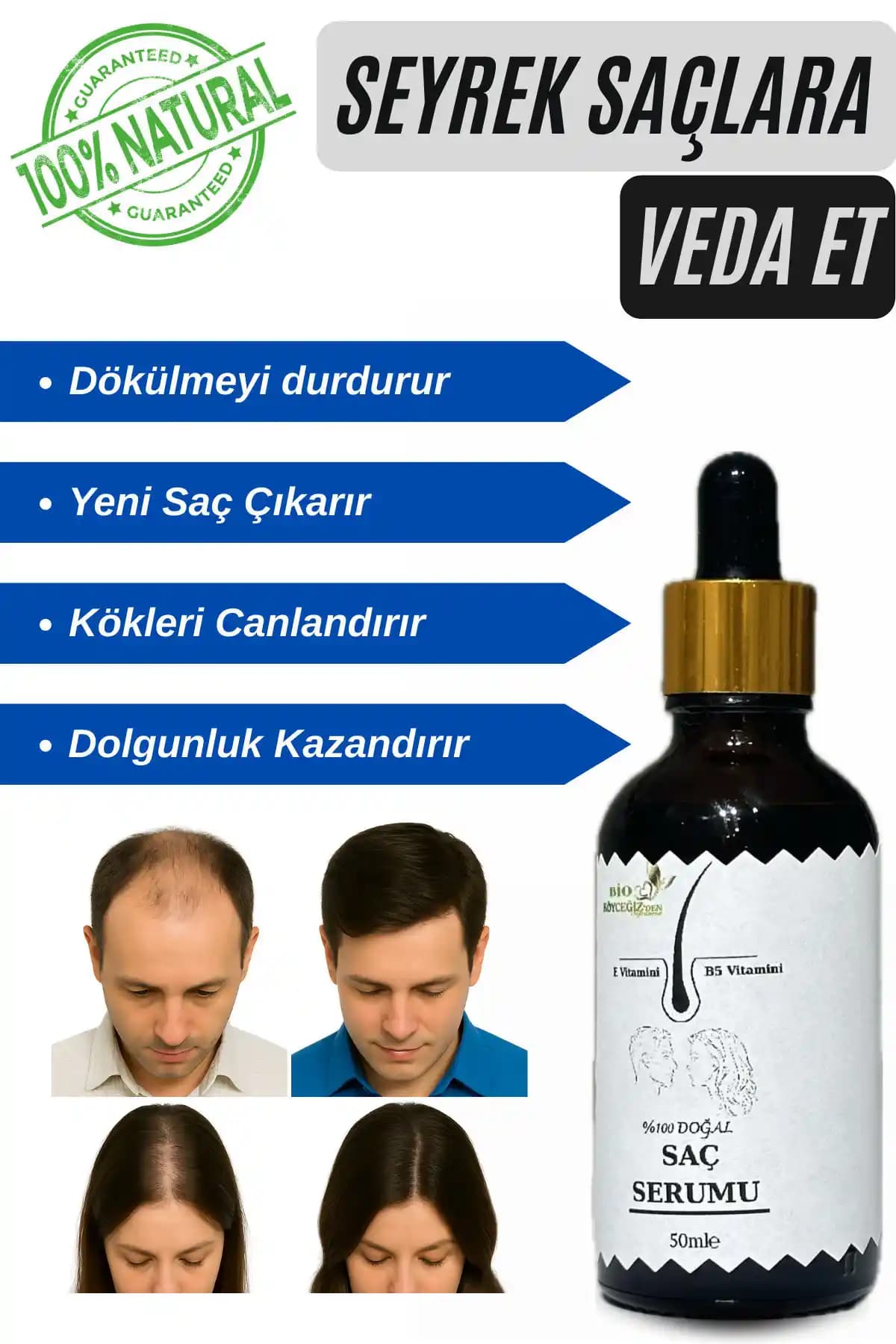 BİO Köyceğiz’den Doğal Saç Serumu: Saç Dökülmesini Azaltan ve Güçlendiren Formül