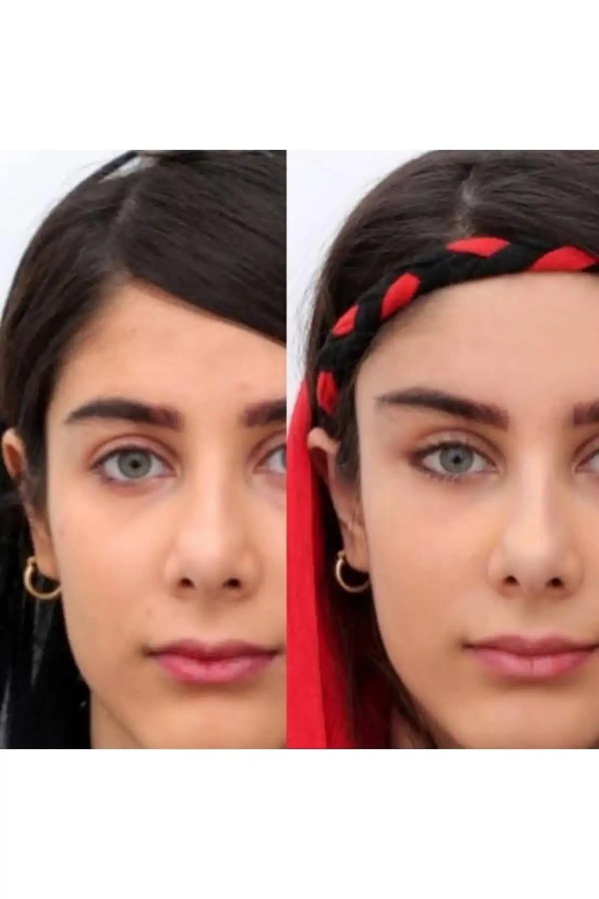 Yüz ve Kaş Germe Tokaları Karşılaştırması: Estetik ve Kullanım Özellikleri 2