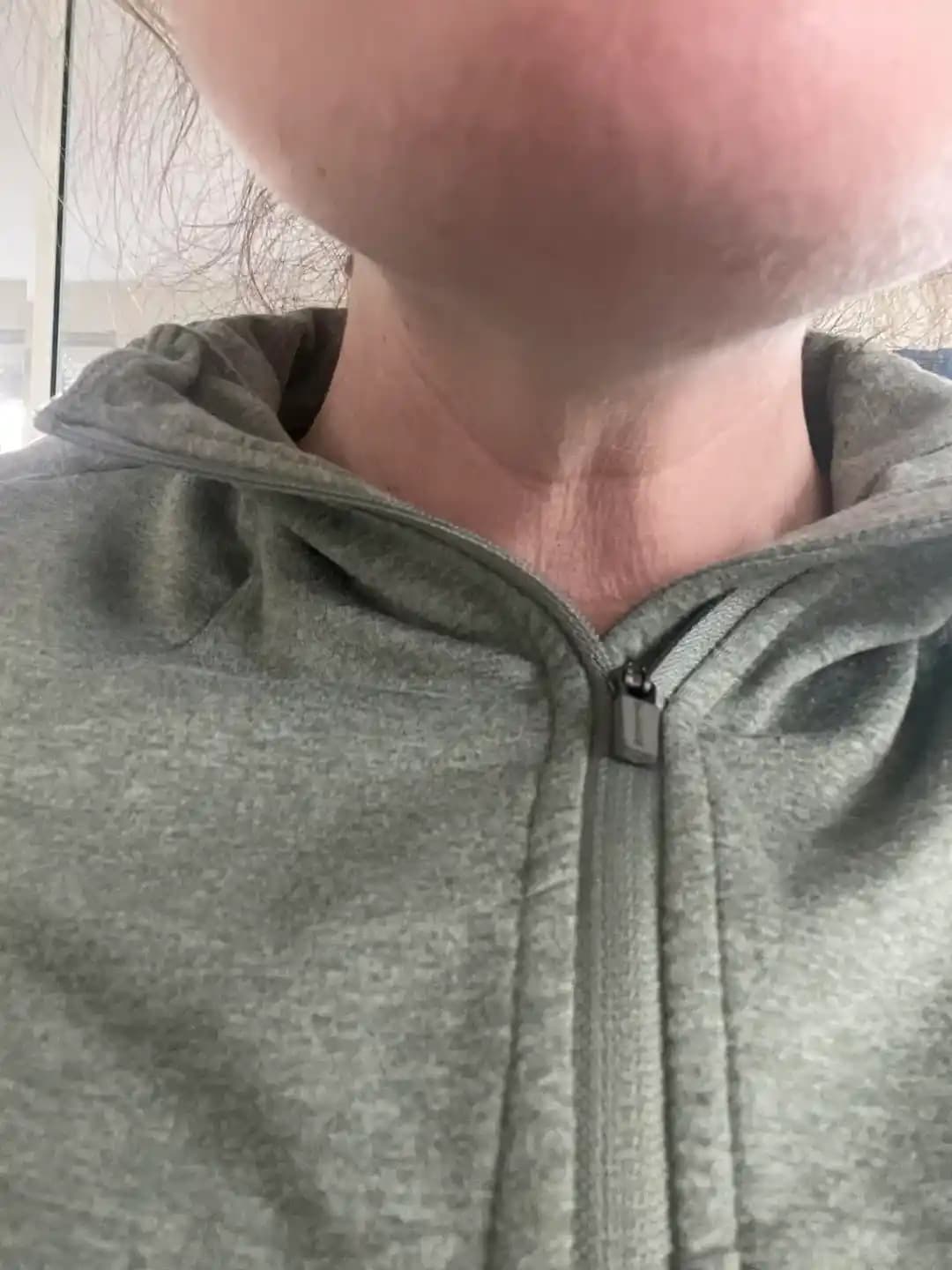 33 Yaşında Boyun ve Çene Altı Cilt Gevşemesi: Nedenleri ve Etkili Çözümler