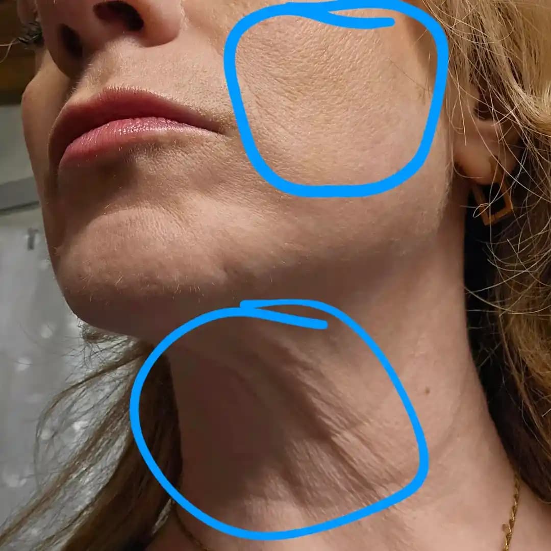 50 Yaş Üzeri Cilt Bakımında Yüz Bakımı Seçenekleri ve Medikal Müdahalelerin Etkileri