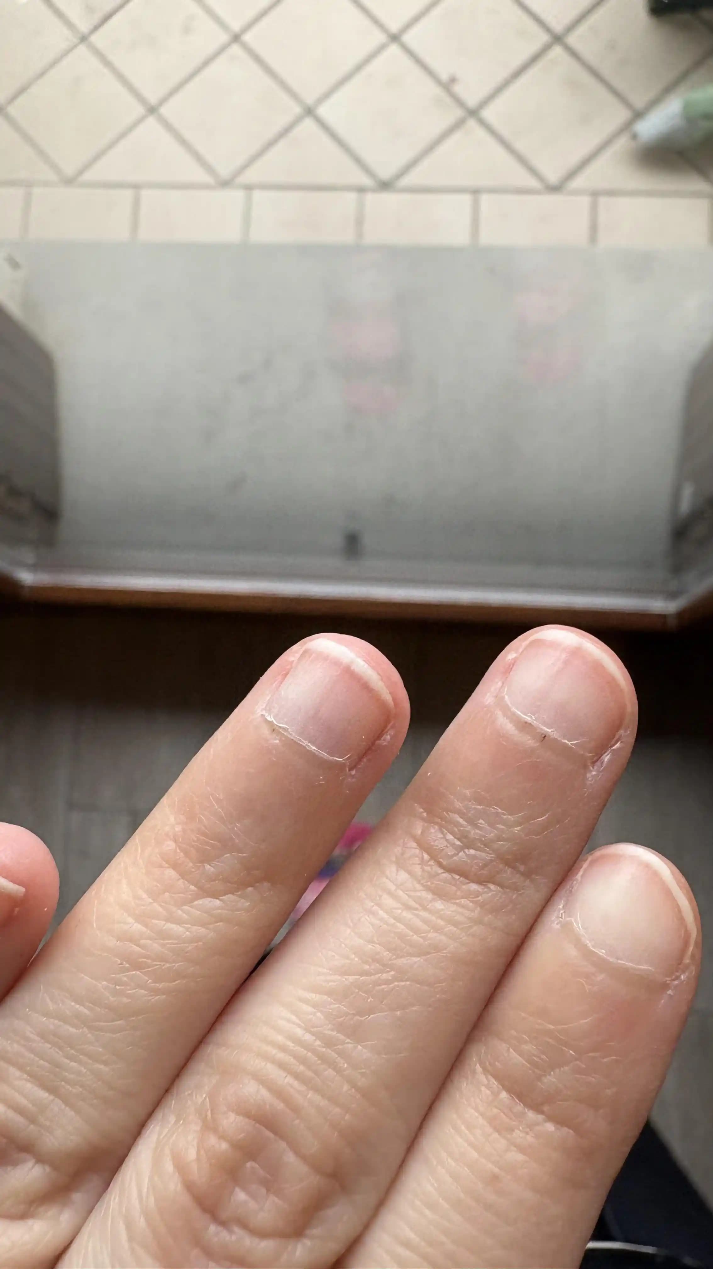 Tırnak Çevresi ve Kesik Deri Bakımı: Sağlıklı Tırnaklar İçin Öneriler ve Uyarılar