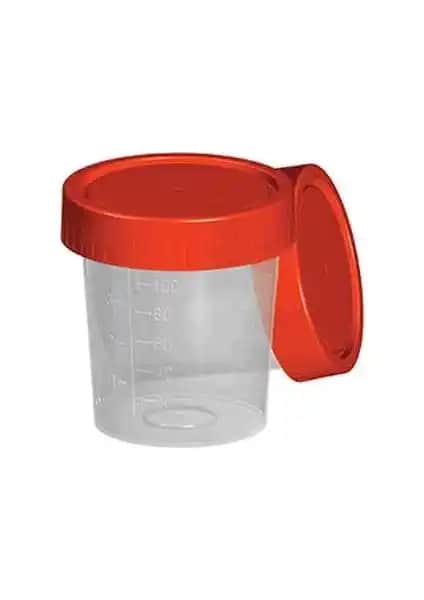 Aromel Steril İdrar Numune Kabı: Güvenli ve Kullanışlı Laboratuvar Çözümü