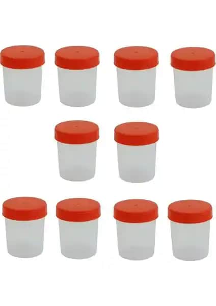 Ayset Steril 100 ml İdrar Numune Kabı Güvenilir ve Pratik Laboratuvar Çözümü