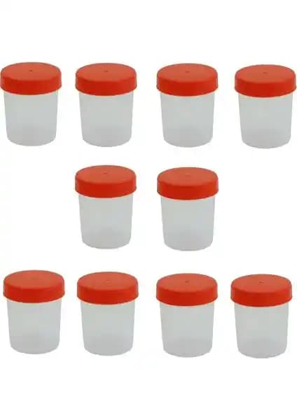 Ayset Steril 100 ml İdrar Numune Kabı Güvenilir ve Pratik Laboratuvar Çözümü