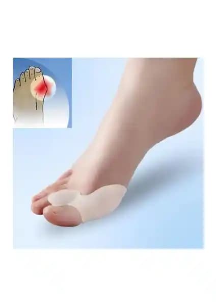 İhtiyaç AVM Baş Parmak Kemik Düzeltici: Ayak Sağlığını Destekleyen Modern Çözüm