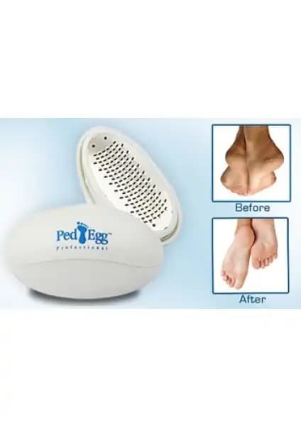 Magic Gift Ped Egg Topuk Törpüsü ile Ayak Bakımında Yenilikçi ve Hijyenik Çözüm