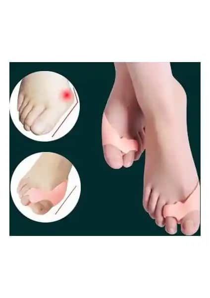 Original Boutique Ayak Bunion Koruyucu: Konfor ve Sağlık İçin Etkili Çözüm