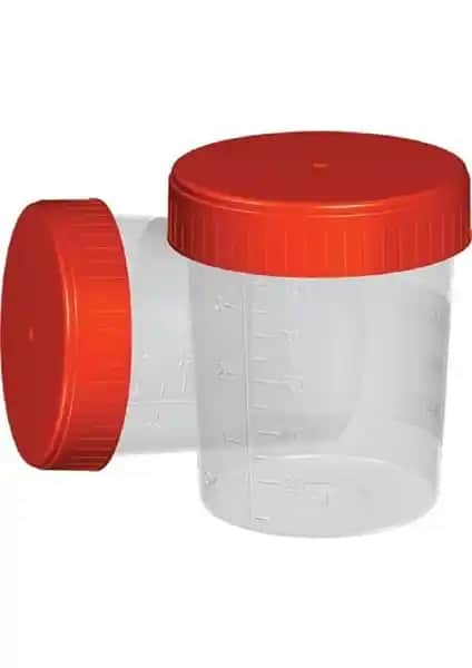 Yerli Poşetli Steril İdrar Numune Kabı: Klinik ve Laboratuvar Kullanımı İçin Güvenilir Çözüm