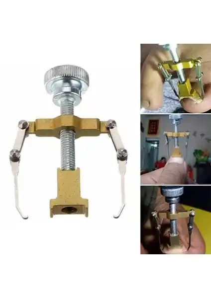 Batık Tırnak Sorunlarına Pratik Çözüm Sunan Pi İthalat Düğüm Tırnak Düzeltme Aleti