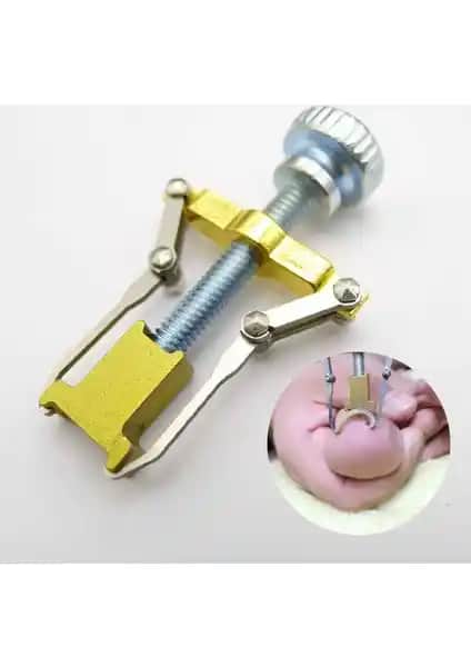 Ecoform Batık Tırnak Çıkartma Aparatı: Güvenilir ve Etkili Tırnak Sağlığı Çözümü