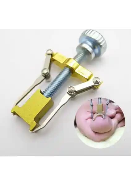 Ecoform Batık Tırnak Çıkartma Aparatı: Güvenilir ve Etkili Tırnak Sağlığı Çözümü