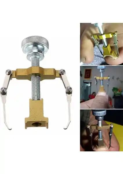 Greathings Profesyonel Batık Tırnağı Düzeltme Aparatı: Etkili ve Pratik Çözüm