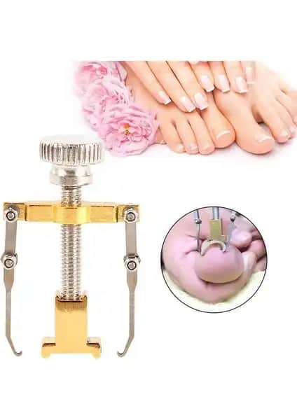 Tırnak Sağlığı ve Estetiği İçin Yenilikçi Batık Tırnak Sökme Aparatı Kullanımı ve Avantajları