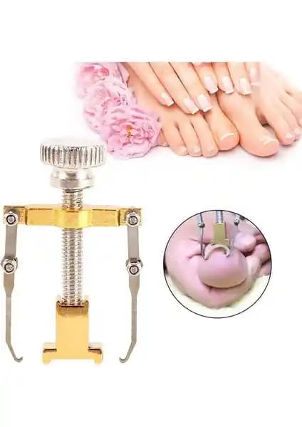 Tırnak Sağlığı ve Estetiği İçin Yenilikçi Batık Tırnak Sökme Aparatı Kullanımı ve Avantajları