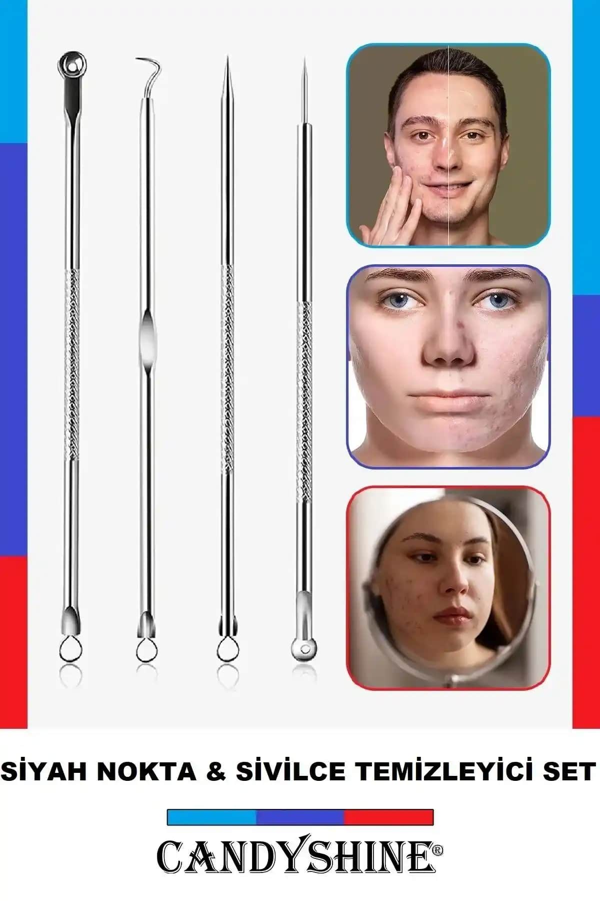 Akne-Siyah Nokta Temizleyici 4'lü Set - Etkili Cilt Bakımı