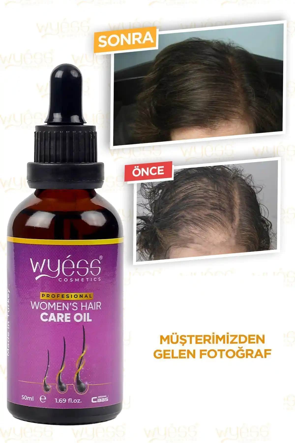 Kadın Saç Bakım Yağı-Serumu: Saç Dökülmesine Karşı Etkili Çözüm