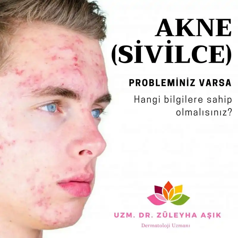 5 Yaşta Sivilce Nedenleri ve Çocuklarda Cilt Bakımı Yöntemleri