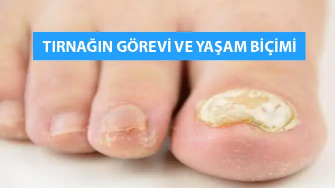 Ayak Tırnağı Kırılması: Nedenleri, Belirtileri ve Korunma Yöntemleri Hakkında Detaylı Bilgi